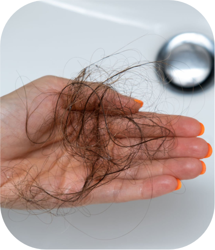 Hairfall And Dandruff