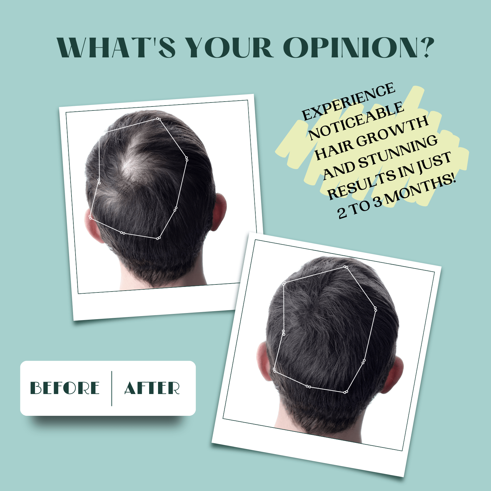 Intense Gro scalp and hair-strengthening oil | 100 Ml - Alif Naturals