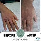 Eczema Cream | 200 ML - Alif Naturals