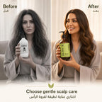 ALIF Naturals Tea Tree shampoo gentle scalp care comparison graphic
